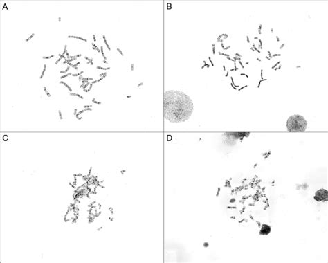 Stained metaphase spreads of varying chromosome morphology and ...