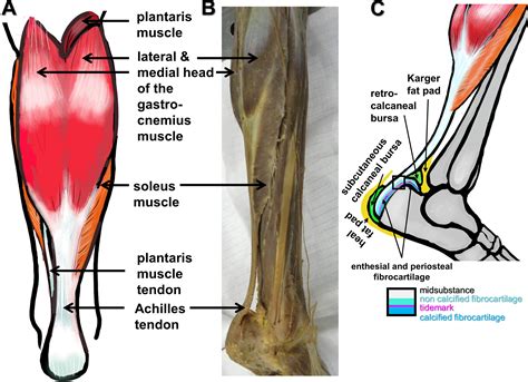 Tendon healing: a concise review on cellular and molecular mechanisms ...