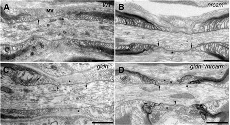 Peripheral Nerve Histology Nodes Of Ranvier