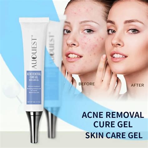 Aliexpress.com : Buy Pimple Remover Gel Inhibit Pimple Growth Remove ...