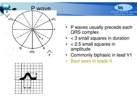 CVT Mohd Farid: Basic ECG Part III-P Wave & PR Interval