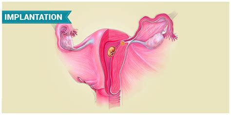 An Overview Of Implantation & Implantation Bleeding