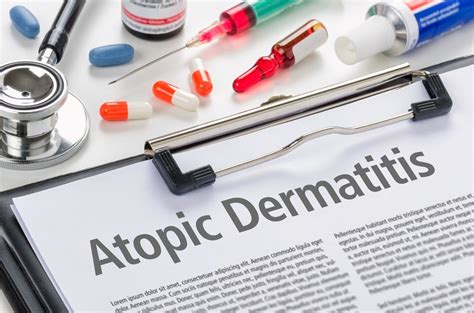 Atopic dermatitis: Pfizer’s abrocitinib study acieves co-primary endpoints