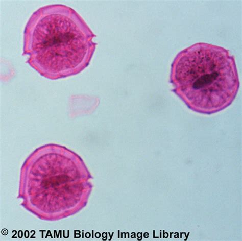 Peridinium Under Microscope