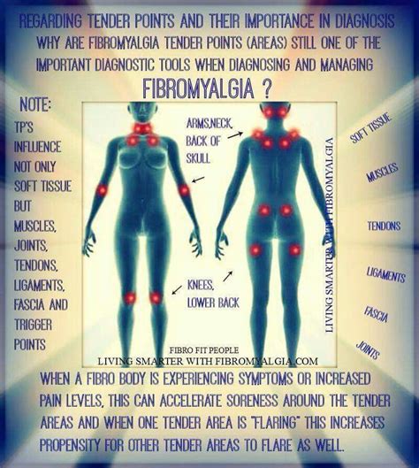 Fibromyalgia Chronic Illness, Chronic Pain, Knee Ligaments, Tonsil ...