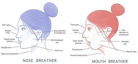 Mouth breather - Long in the tooth - common dental phrases