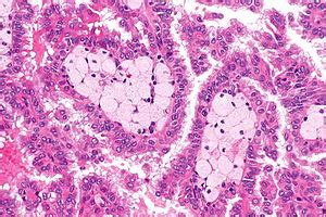 Renal Papilla Histology