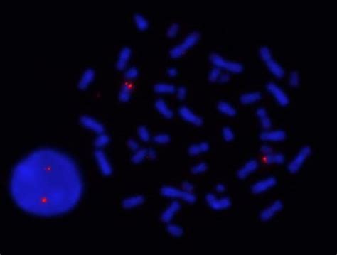 Haematology FISH probes | Scientist Live