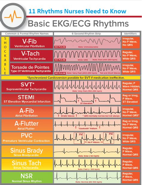 Ekg Interpretation Cheat Sheet / EKG/ECG Cheat Sheet | Nursing tips ...