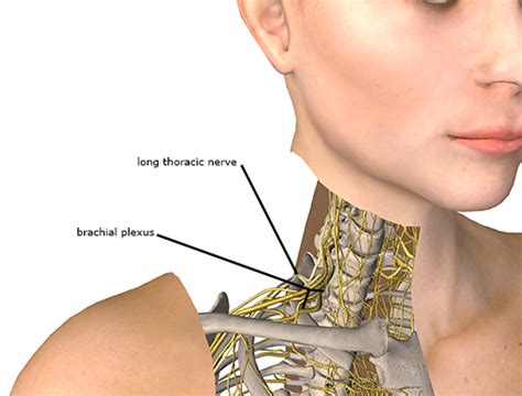 Long Thoracic Nerve Compression - Academy of Clinical Massage