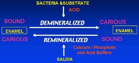 Dental Mnemonics: Cariogenic Bacteria