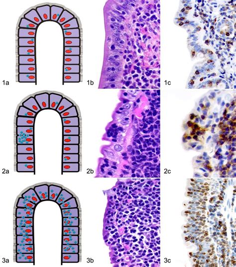 Small intestine: cat. Single intraepithelial lymphocytes: pattern of... | Download Scientific ...