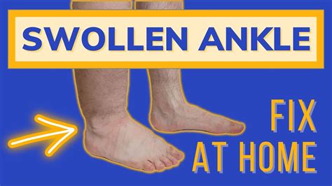 Swollen Painful Ankles, Fix them At Home! - YouTube