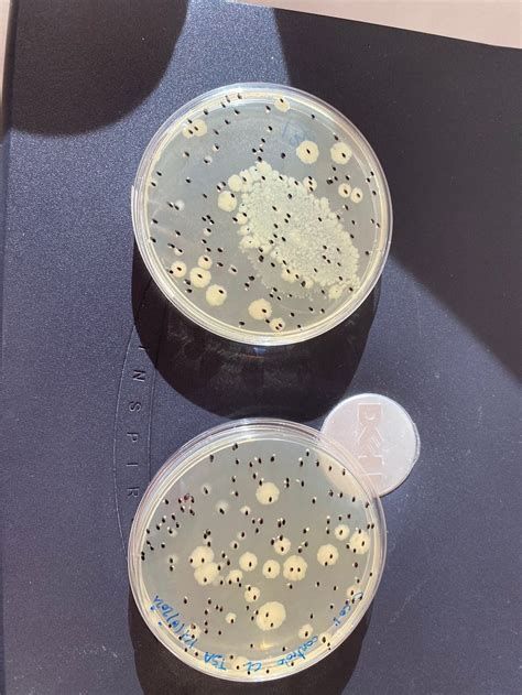 Merging of colonies in pour plate and spread method? | ResearchGate