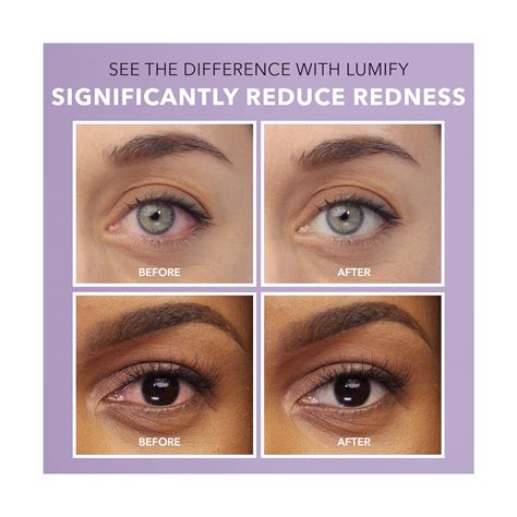 Lumify Redness Reliever Eye Drops | Pick Up In Store TODAY at CVS