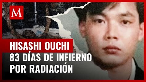 La trágica historia de Hisashi Ouchi, el hombre que sufrió la mayor ...