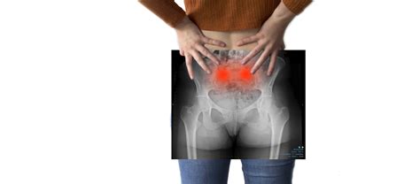 What Is Sacroiliac Joint Pain And How Can You Treat It? | Smileybelt