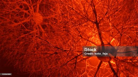 Neuron System Disease Stock Photo - Download Image Now - Central Nervous System, Multiple ...