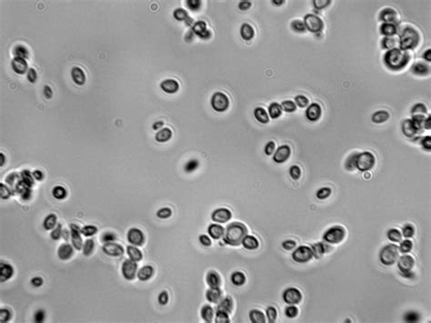 Saccharomyces Cerevisiae Under Microscope | Images and Photos finder