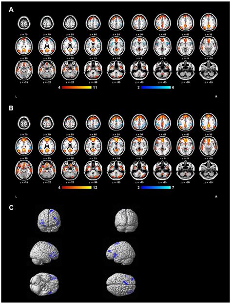 Frontiers | Default mode network alterations during implicit emotional faces processing in first ...