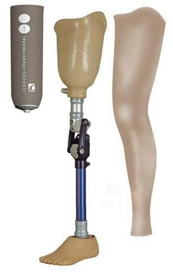 Above Knee Silicone prosthesis, Full Leg, Nulife Health Care | ID ...