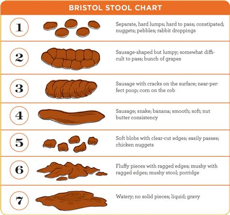 Pencil thin stool hemorrhoids: “Low caliber stool” and “pencil thin ...