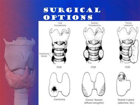 Thyroid surgery and neoplasms of thyroid