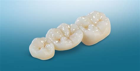 BruxZir Zirconia | New West Dental Lab | Bruxzir Esthetic Lab