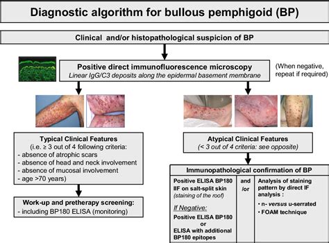 Bullous Pemphigoid: A Review of its Diagnosis, Associations and Treatment | Semantic Scholar