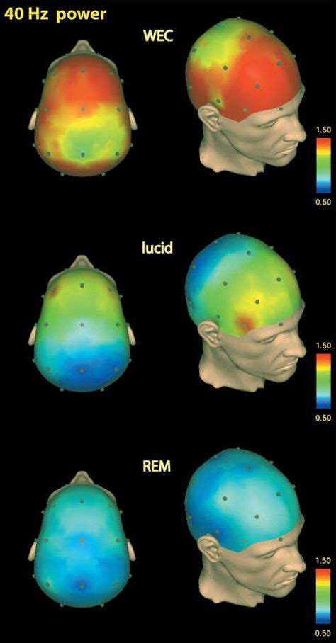 This pin illustrates an individual's brain activity during different ...