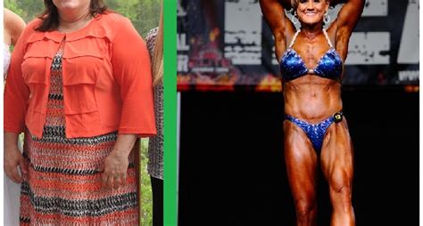 She lost 120 pounds after bariatric surgery. Now she is a professional ...