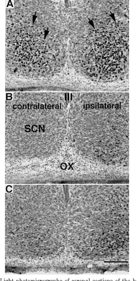 Figure 1 from Unilateral optic nerve transection alters light response ...