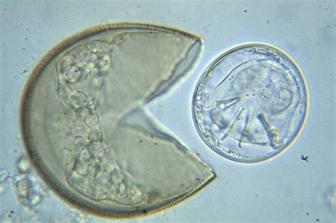 Hatched egg of tapeworm (sp. Hymenolepsis diminuta) | Tapeworm | Nikon ...