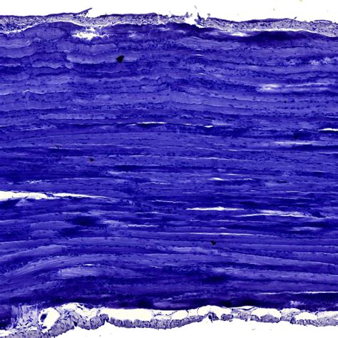 Solution Skeletal Muscle Anatomy Studypool - vrogue.co