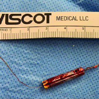 Clinical photograph showing the impaled probe with TASER wire. a... | Download Scientific Diagram