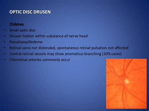 Optic disc evaluation