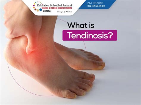 What is Tendinosis?