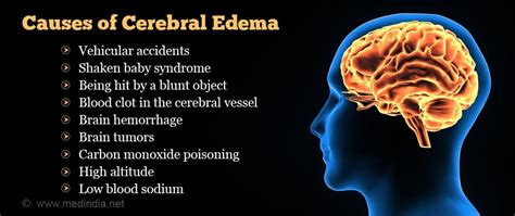 Cerebral Edema - Causes Symptoms Diagnosis Treatment Prevention