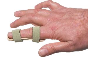 Treatment for Broken Finger - Medical Experts