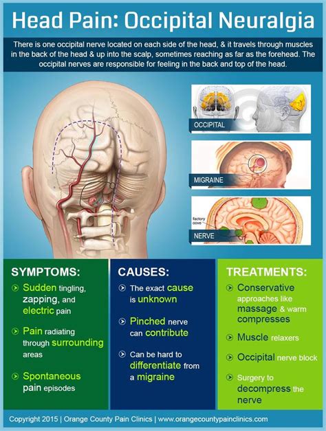 Pin on Migraine headaches