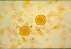 Protozoa, Intestinal flagellates, Phylum Sarcomastigophora, Subphylum: Mastigophora, Giardia ...