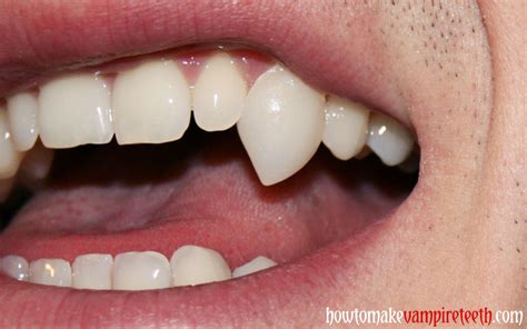 how to make vampire teeth | Proper Use of Your New Vampire Fangs