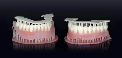 Digital Denture Philanthropy Thanks to SprintRay 3D Printers