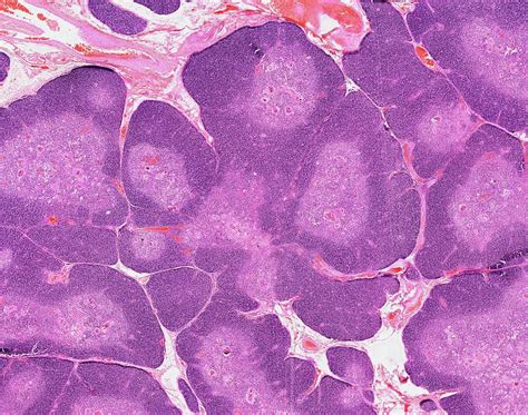 Thymus Gland Histology