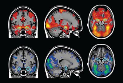 How Scientists Are Tackling Brain Imaging's Replication Problem | The Scientist Magazine®