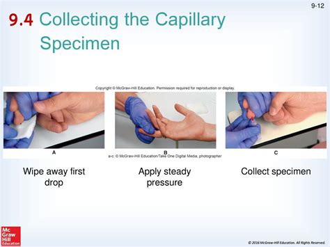 Dermal/Capillary Puncture - ppt download