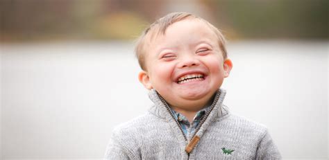 What is Down Syndrome - Down Syndrome Symptoms & Tests to Detect it ...