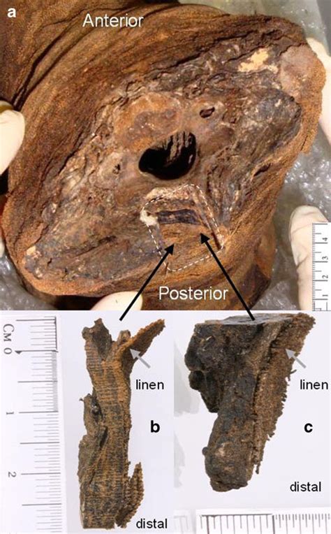 a Photograph of an Egyptian mummy head showing a cross section of the... | Download Scientific ...