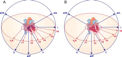 A Schematic illustration of the relationship between normal electrical ...