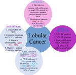 Frontiers | Lobular Breast Cancer: A Review | Oncology